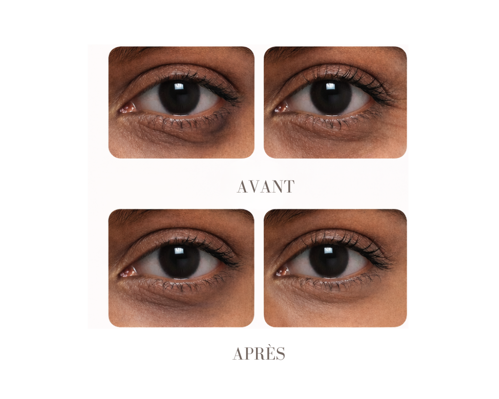 🌿 CurcEyes Patchs anti-cernes au Curcuma & Collagène