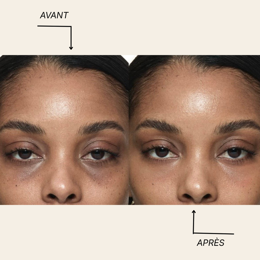 🌿 CurcEyes Patchs anti-cernes au Curcuma & Collagène